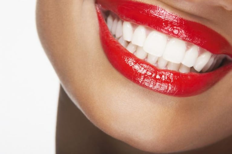 Los tips para mejorar los "dientes amarillos"