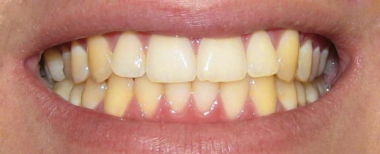 Los tips para mejorar los "dientes amarillos"