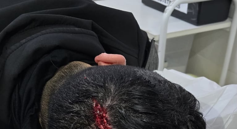 Los uniformados tuvieron que ser atendidos en el hospital local.