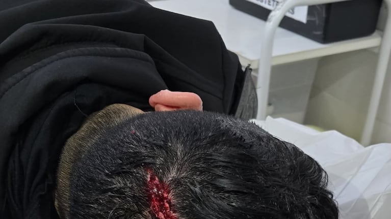 Los uniformados tuvieron que ser atendidos en el hospital local.