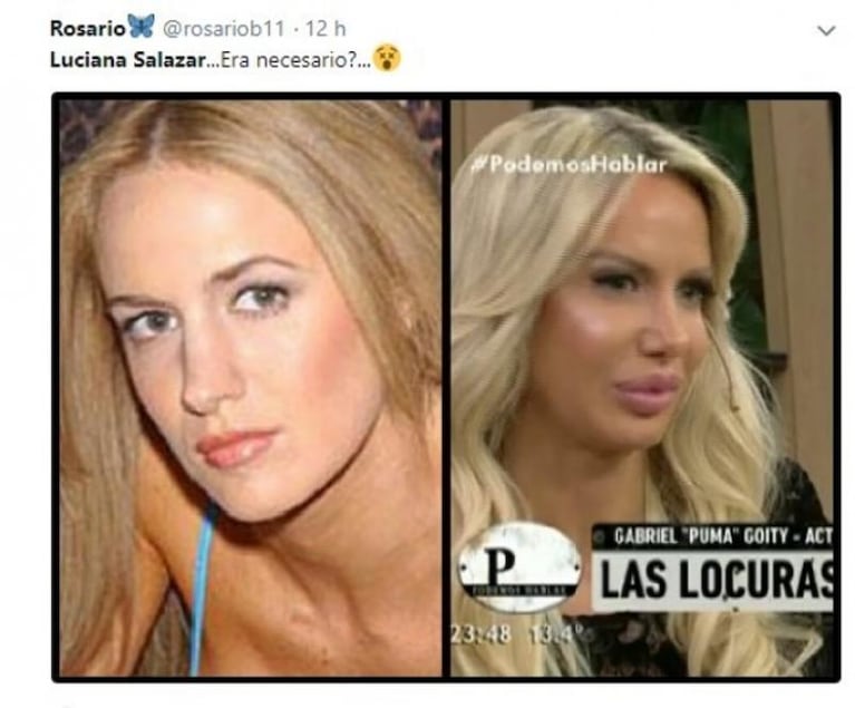 Luciana Salazar habló de sus cirugías y estallaron las memes