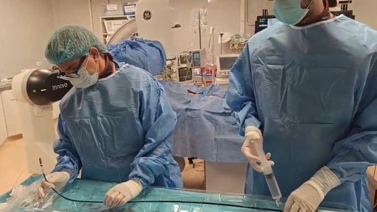 Médicos del Hospital Córdoba realizaron el primer implante de marcapasos sin cable en un centro público de la provincia.