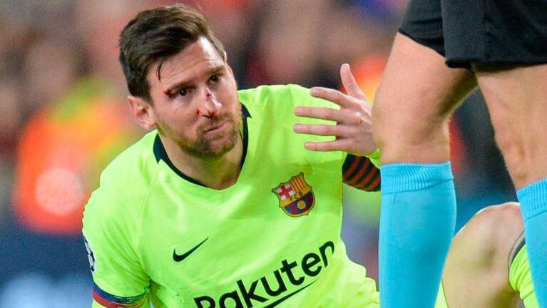 Messi, ensangrentado en el partido Manchester United-Barcelona