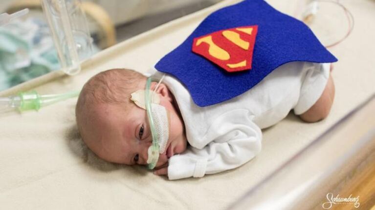 MiniSuperman, uno de los bebés prematuros que enternecieron en las redes con sus disfraces.