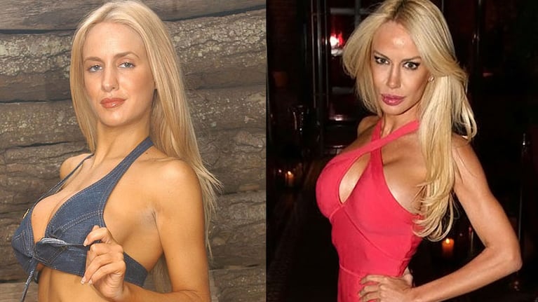 Modelos y actrices que pasaron por el quirófano.