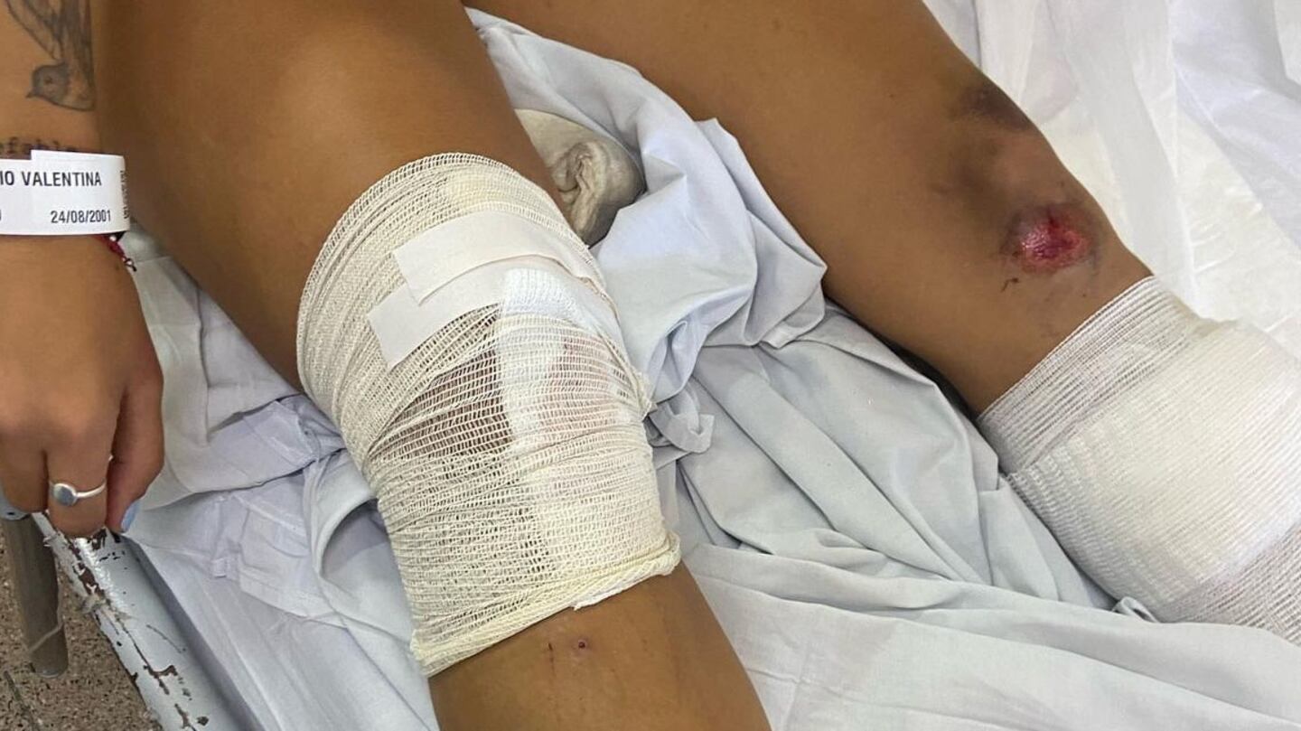Motochoros robaron y arrastraron a una joven