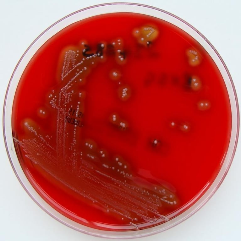 Murieron cuatro niños por una bacteria que se aloja en las vías respiratorias