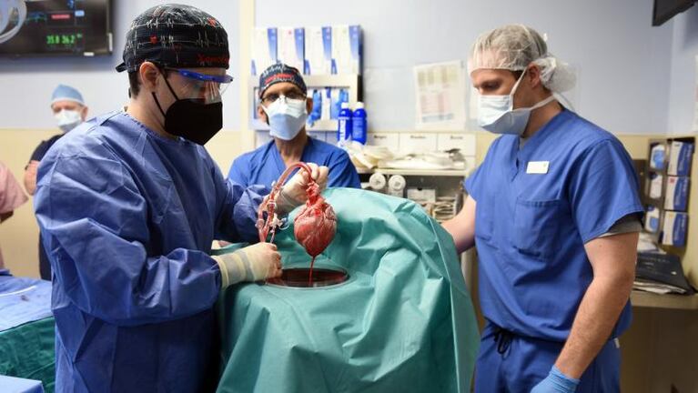 Murió el primer paciente trasplantado con un corazón de cerdo 