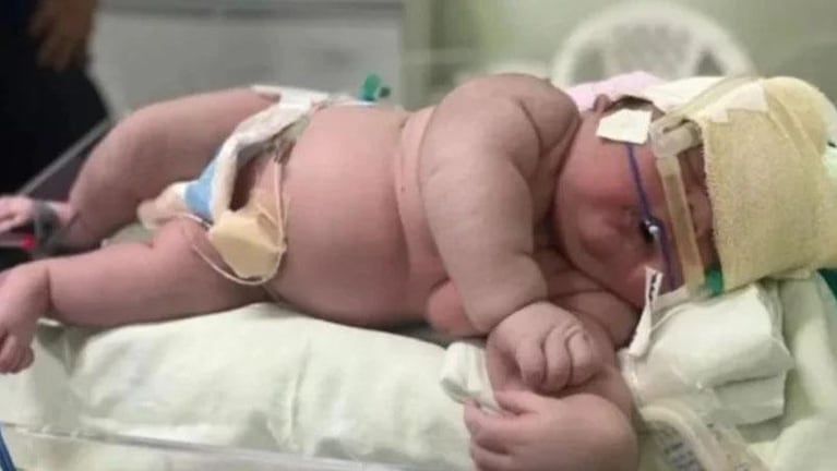 Nació un bebé gigante de más de 7 kilos en Brasil: las impactantes fotos