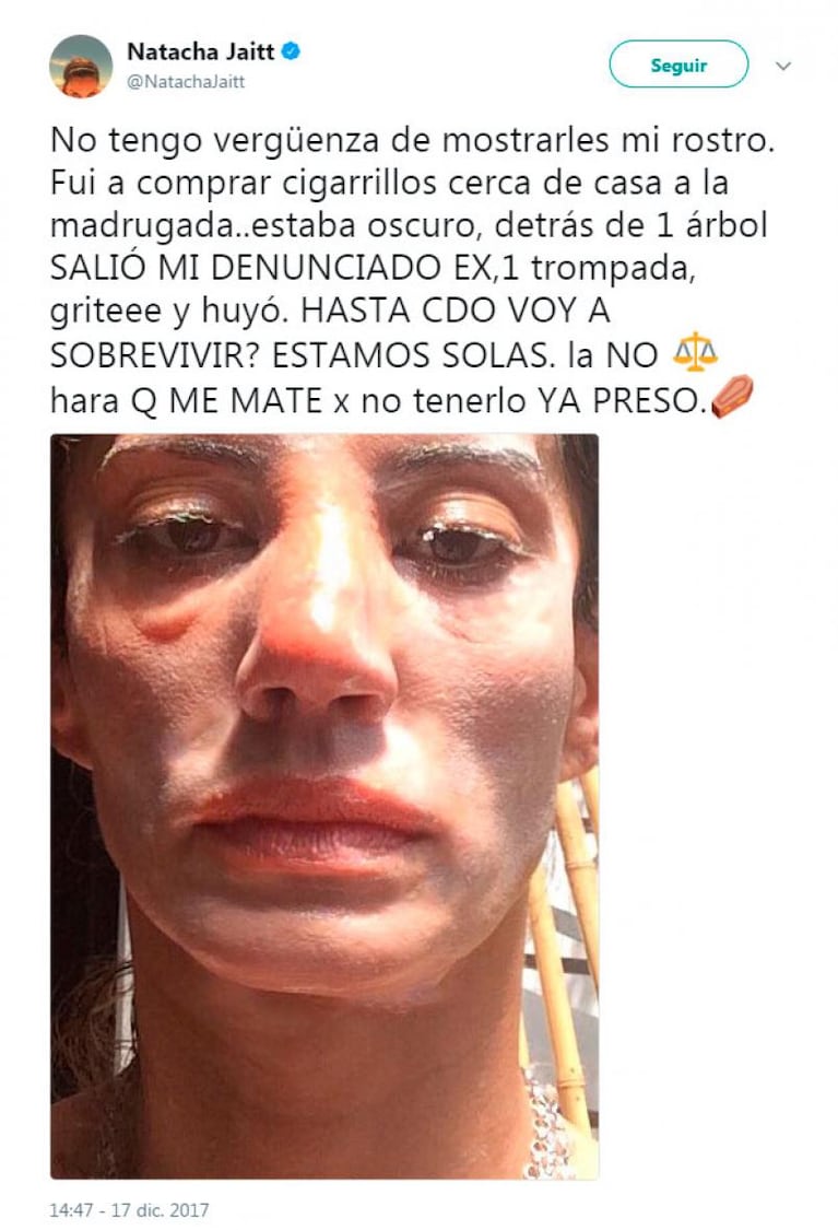 Natacha Jaitt mostró su cara tras ser golpeada por su expareja