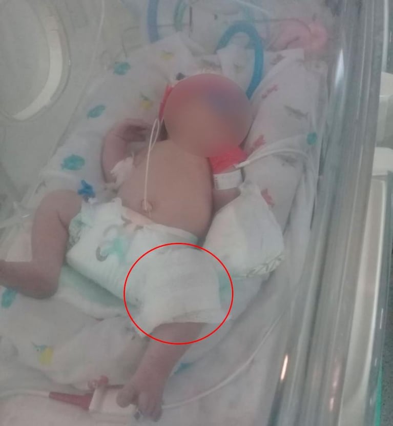 Neonatal: una mamá identificó a la enfermera como posible autora de los pinchazos