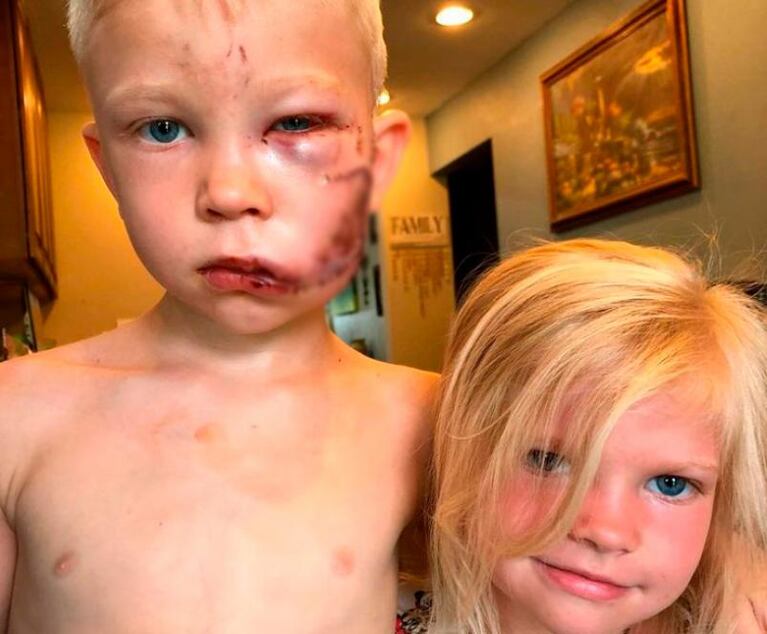 Niño héroe: tiene seis años y salvó a su hermana del ataque de un perro
