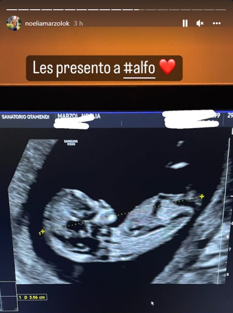 Noelia Marzol compartió la primera imagen de la beba que espera 