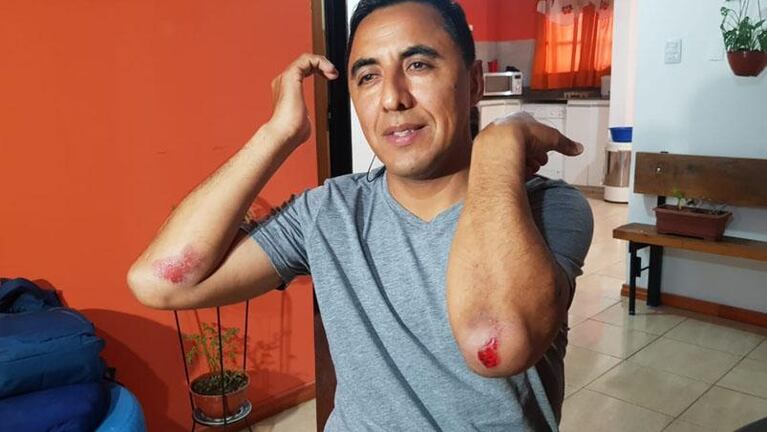 Otro denunciante del Surrbac denunció un violento ataque