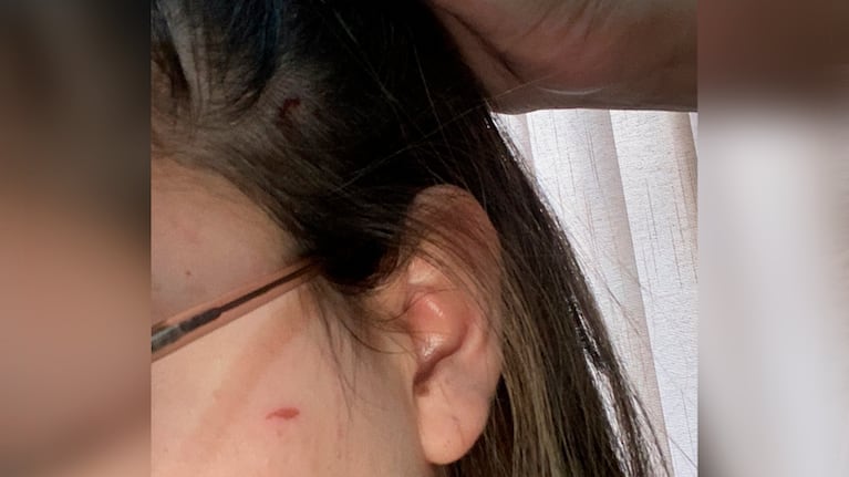 Parte de las heridas que le provocaron a la joven.