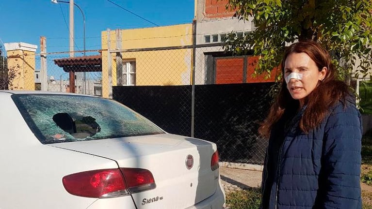 Pidió que bajaran la música y fue brutalmente golpeada: "Son unos sádicos y cobardes"