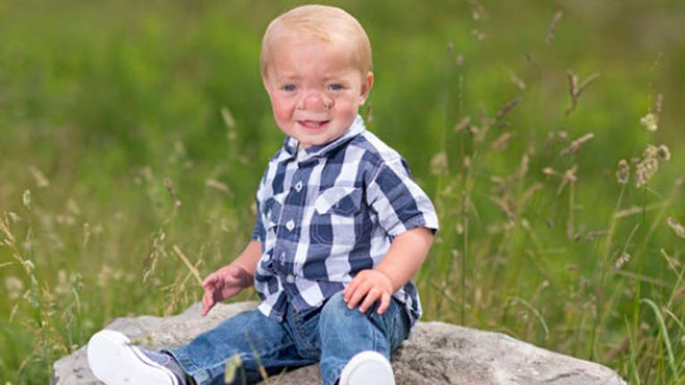 "Pinocho" Ollie tiene 22 meses de vida.