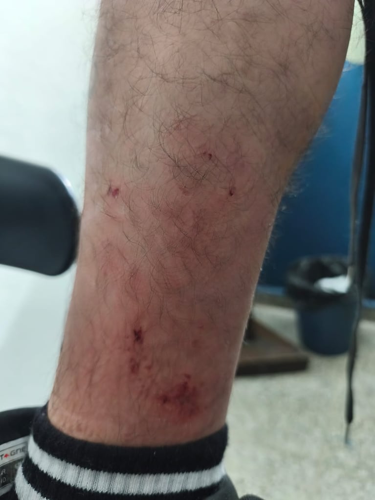 Policía agredido por los perros. Imagen: Policía de Córdoba.