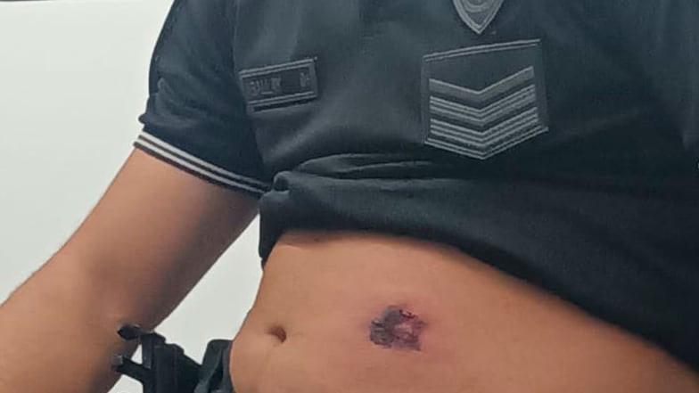 Policía de Córdoba baleado