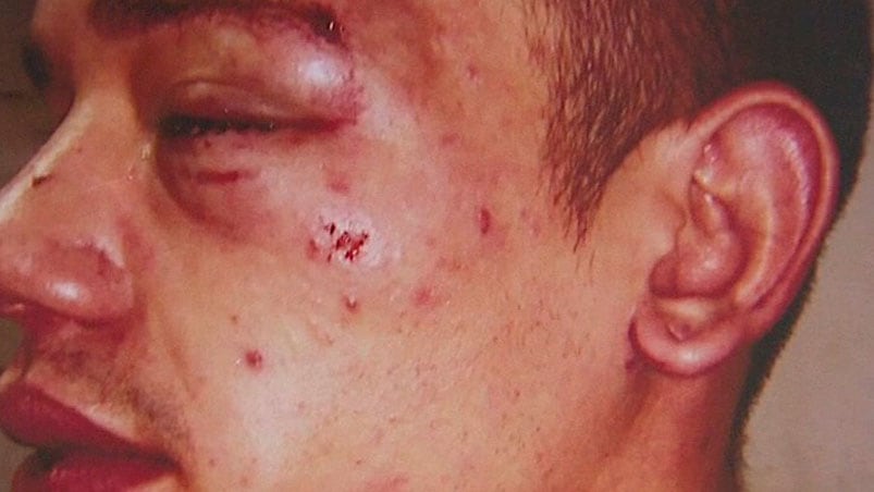 Policías suspendidos, por agredir fuertemente  a un joven