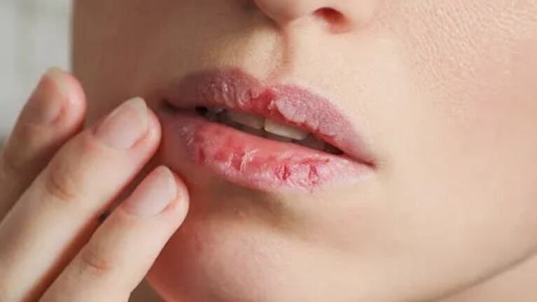 Por qué se secan los labios en invierno y la técnica simple y desconocida para evitarlo