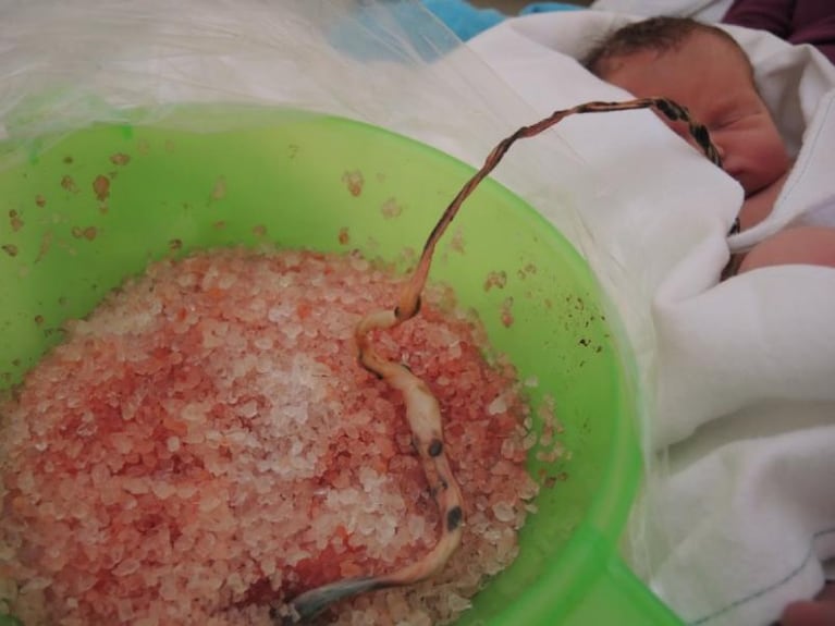 Practicaron un parto naturista y terminaron imputados