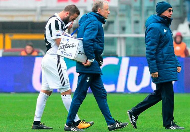 Preocupación en la Selección: Higuaín sufrió una terrible lesión