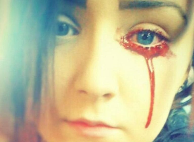 Reino Unido: una joven llora sangre y los médicos no tienen explicación
