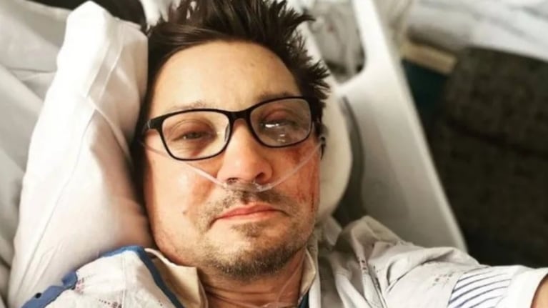 Renner se sometió a múltiples cirugías en poco tiempo durante 2023.