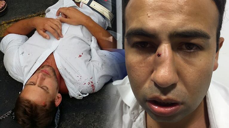 Ruiz y Herrero terminaron en el hospital, tras ser agredidos en Carlos Paz.