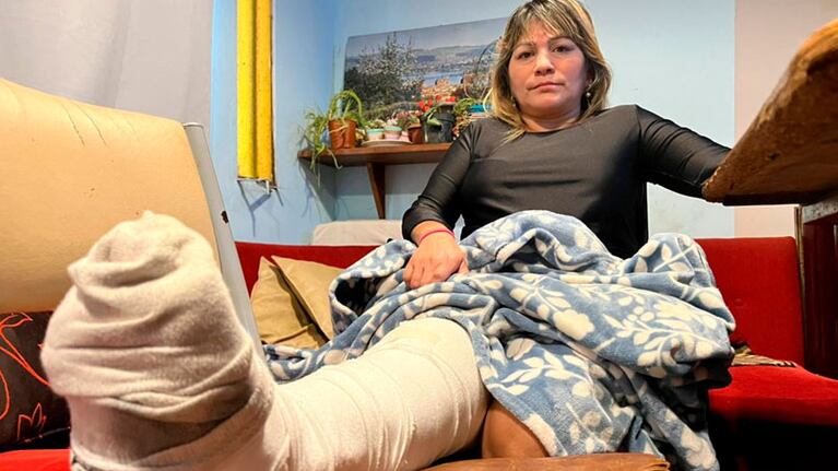 Ruth Torres necesita ayuda para conseguir una prótesis y poder operarse.
