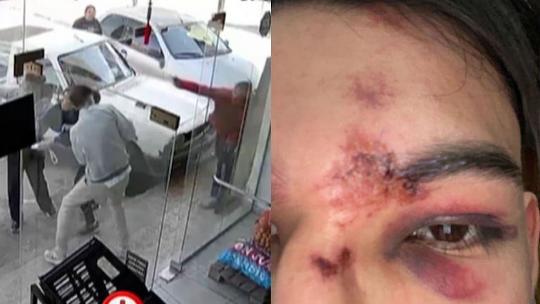 Salvaje agresión a un joven tras un choque en Carlos Paz.