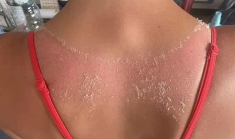 Se compró un top de $7.000 por internet y sufrió algo inesperado en una excursión