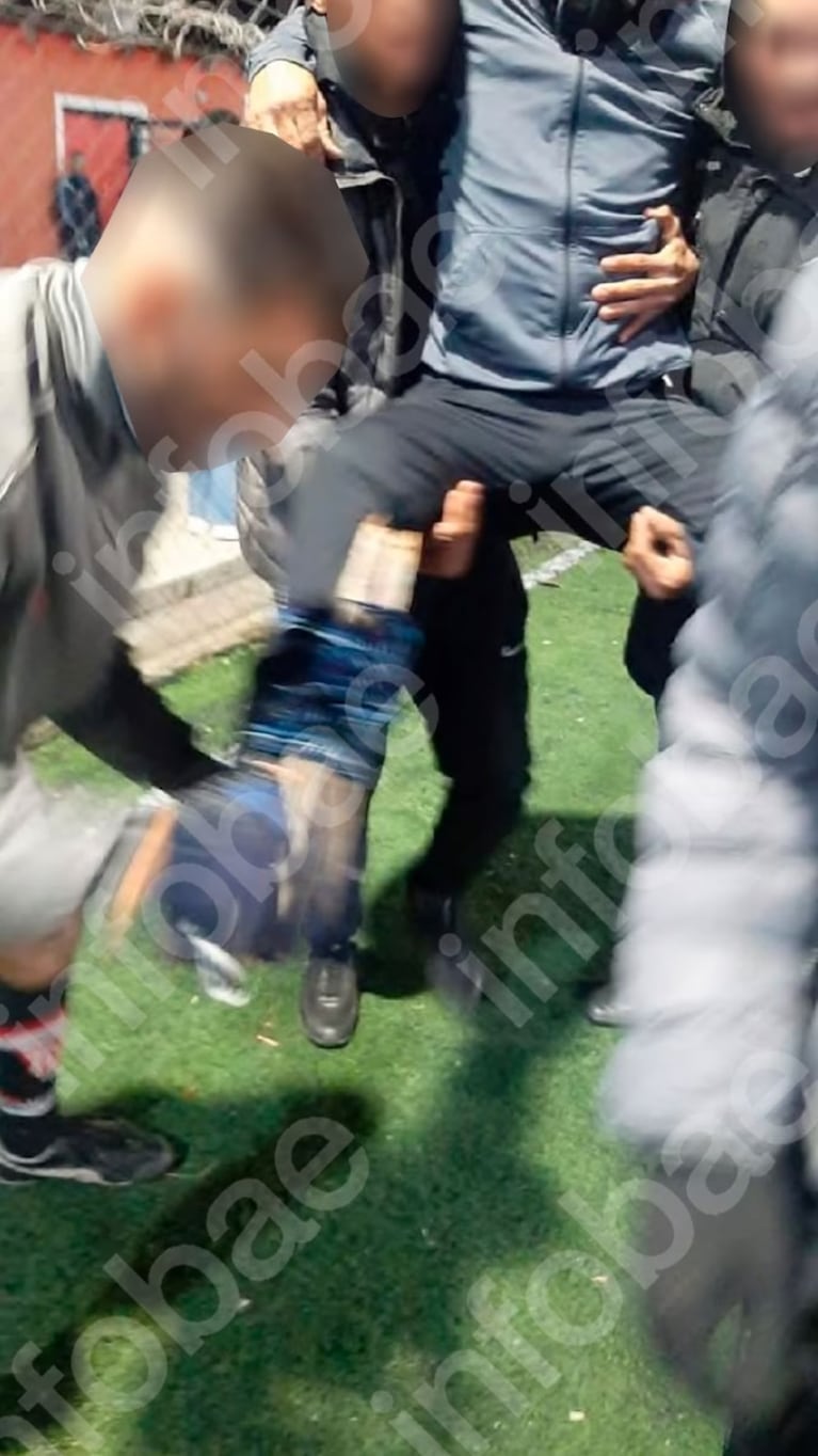 Se fracturó al tropezarse en una cancha de fútbol 5 rota y el predio deberá pagarle millones