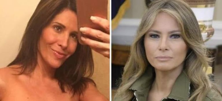 Se operó para parecerse a Melania Trump 