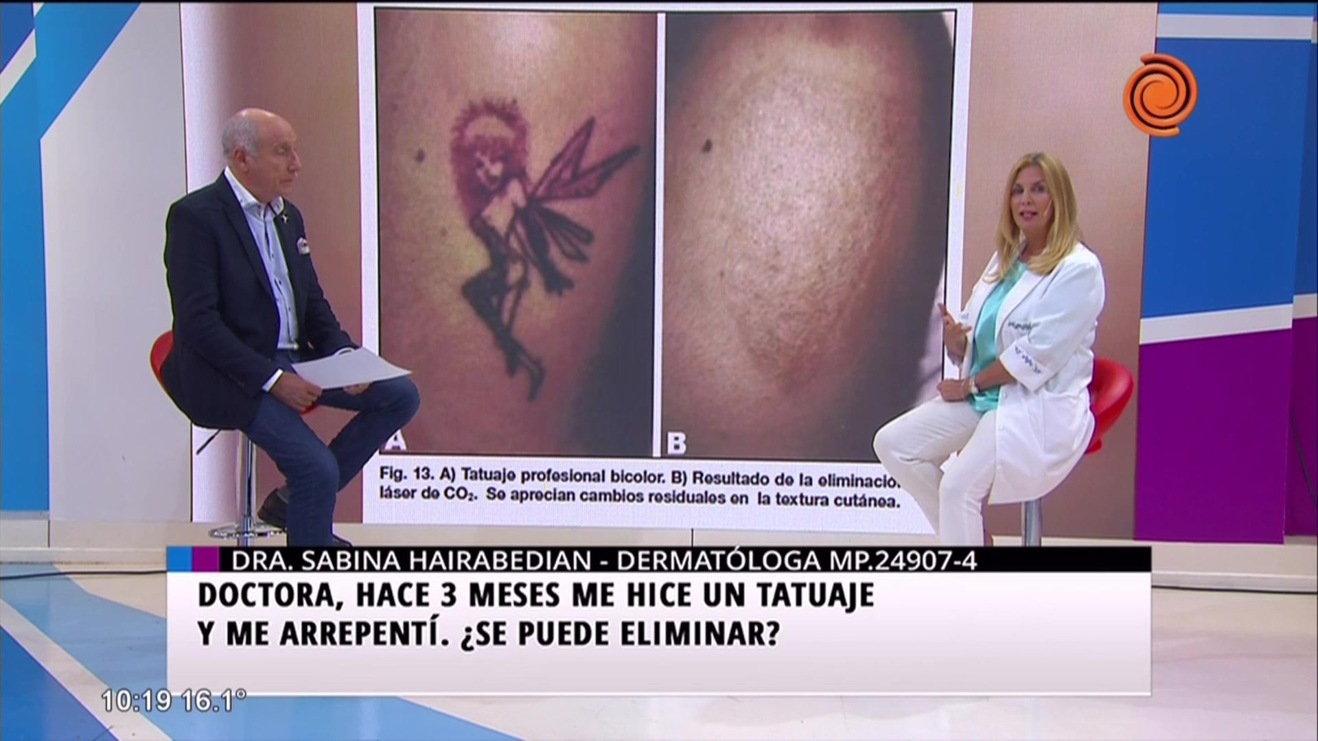 ¿Se pueden eliminar los tatuajes?