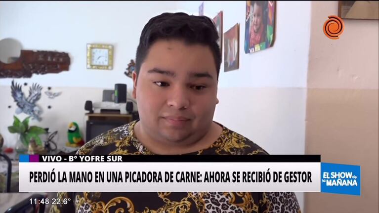 Se recibió de gestión el joven que perdió la mano en su trabajo del PPP