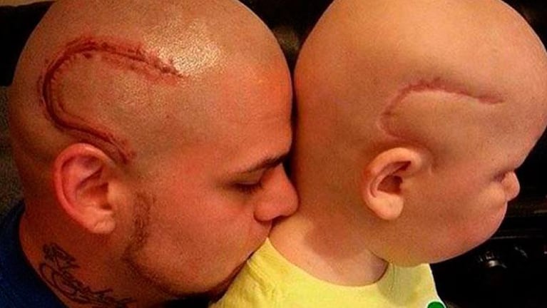 Se tatuó una cicatriz porque su hijo se sentía un monstruo