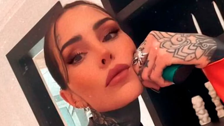 Según la modelo, hablar de este tipo de trastornos es “clave” para sobreponerse.