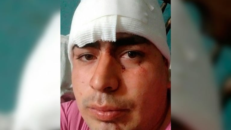 Sergio Dacuar con la venda en su cabeza tras el hecho violento.