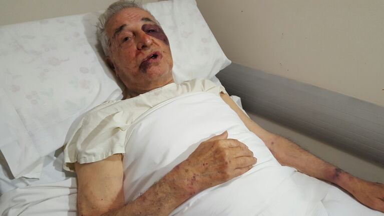 Sin piedad, los ladrones golpearon a don Augusto, que nunca se resistió.