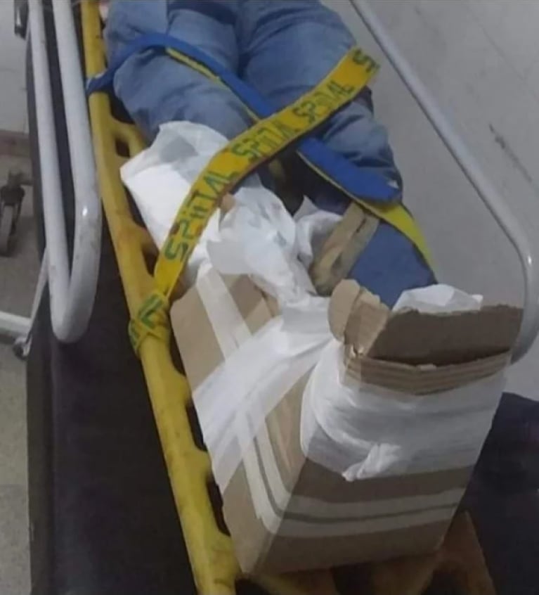 Sufrió una fractura expuesta y fue a un hospital: lo enyesaron con cartones