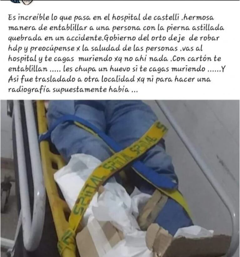 Sufrió una fractura expuesta y fue a un hospital: lo enyesaron con cartones