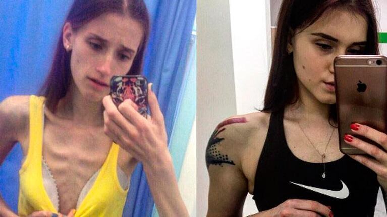 Superó la anorexia y ahora es una gurú del fitness