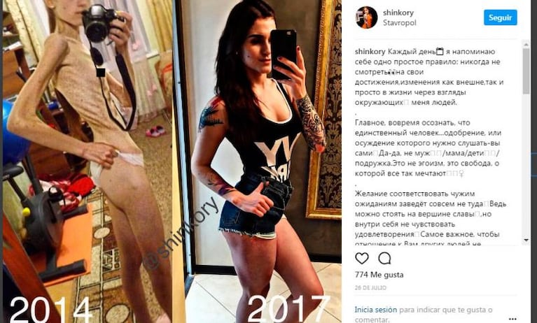 Superó la anorexia y ahora es una gurú del fitness