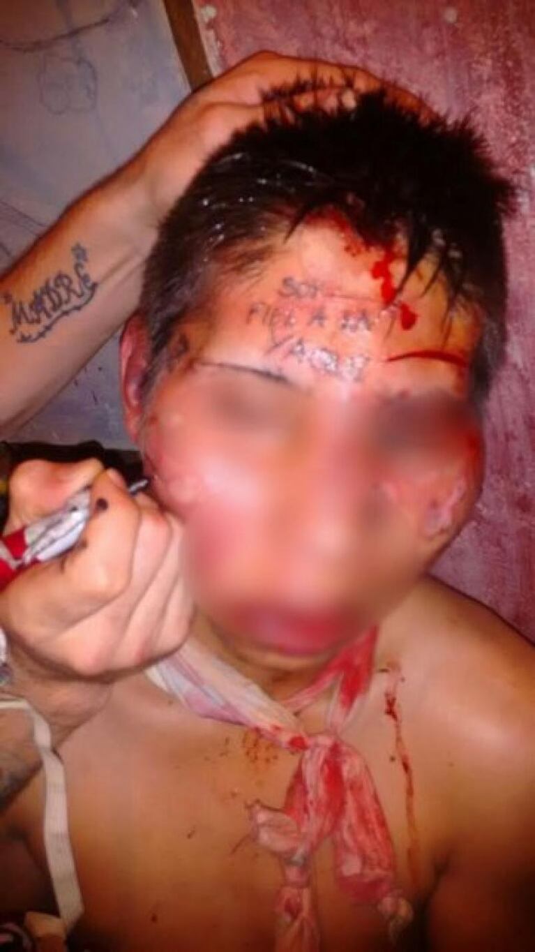 Tatuaron a un preso en la cara con un mensaje mafioso