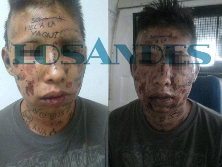 Tatuaron a un preso en la cara con un mensaje mafioso