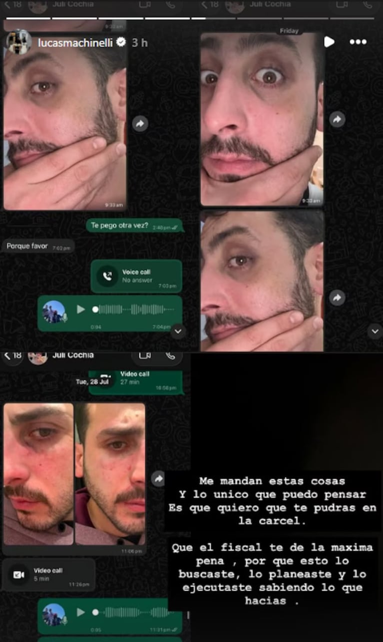 “¿Te pegó otra vez?”: las fotos que revelan la violencia que sufría el joven asesinado por su novia