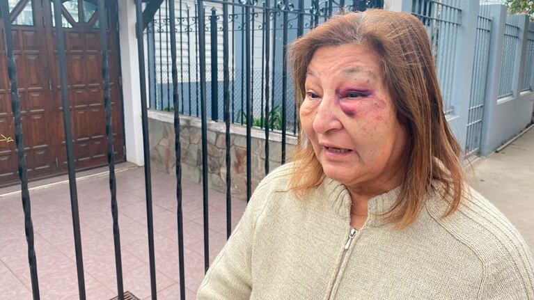 Teresa debió recibir atención médica. Foto: Luchy Ybañez / El Doce.