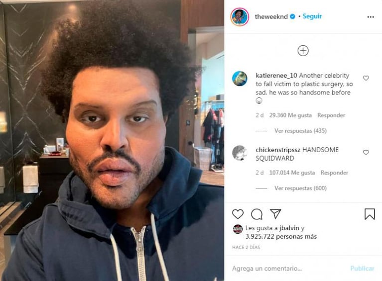 The Weeknd, irreconocible: así se ve el rostro del artista del momento tras varias cirugías